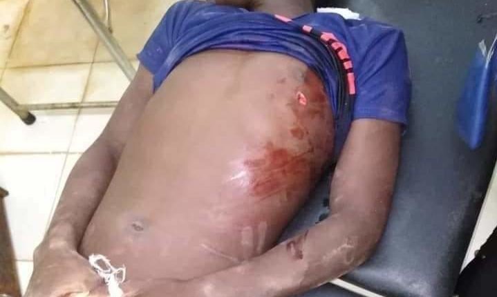 السودان : سقوط 5 قتلى بالرصاص الحي في مواكب مليونية القصاص العادل