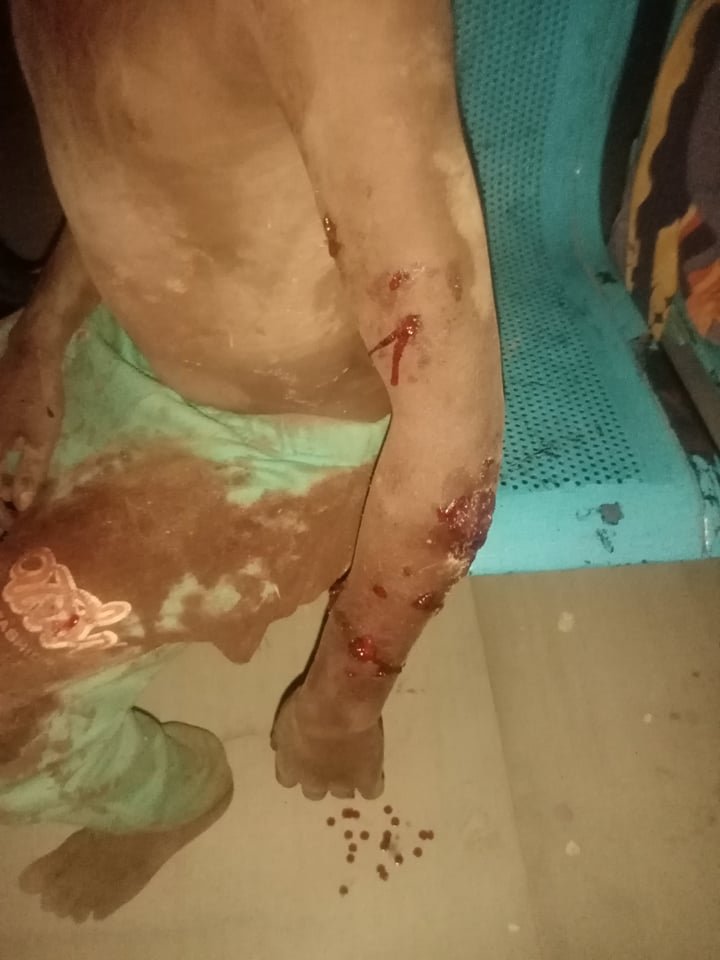 السودان: مقتل طفل واصابة اخرين في قصف جوي لطيران الجيش السوداني وكشف تفاصيل مأساويه عن انتهاكات قوات الدعم السريع.. بالصور