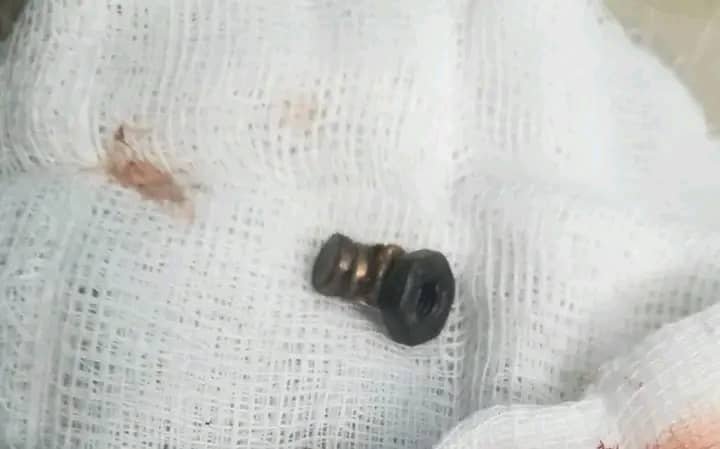 مستشفى ولائي في السودان يتفوق على المستشفيات الأمريكية.. بالصورة