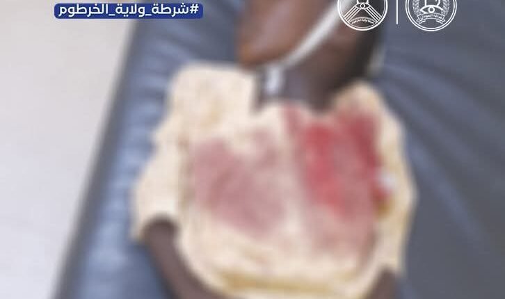 بينما كان نائماً.. عيار ناري طائش يضع حداً لحياة طفل في أم عشر